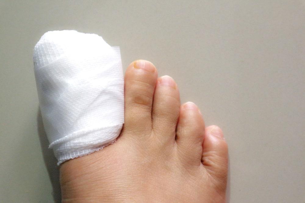 Zoomed in feet with toe wrapped in bandage