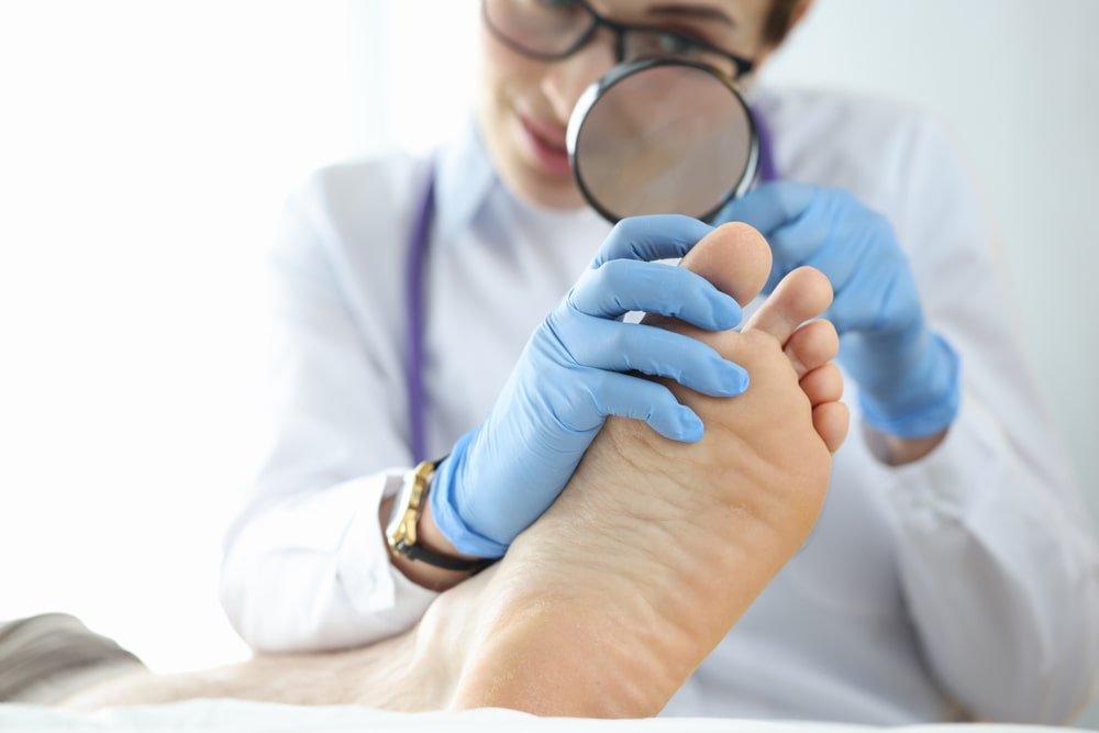 A Doctor With a Magnifying Glass Examining One of the Different Types of Toenail Fungus on Foot