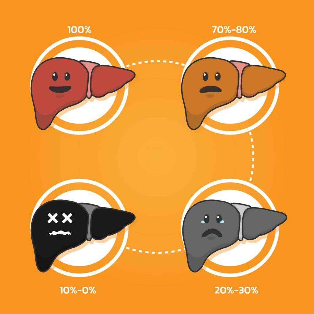 what-are-the-4-stages-of-liver-disease-2023-purehealth-research