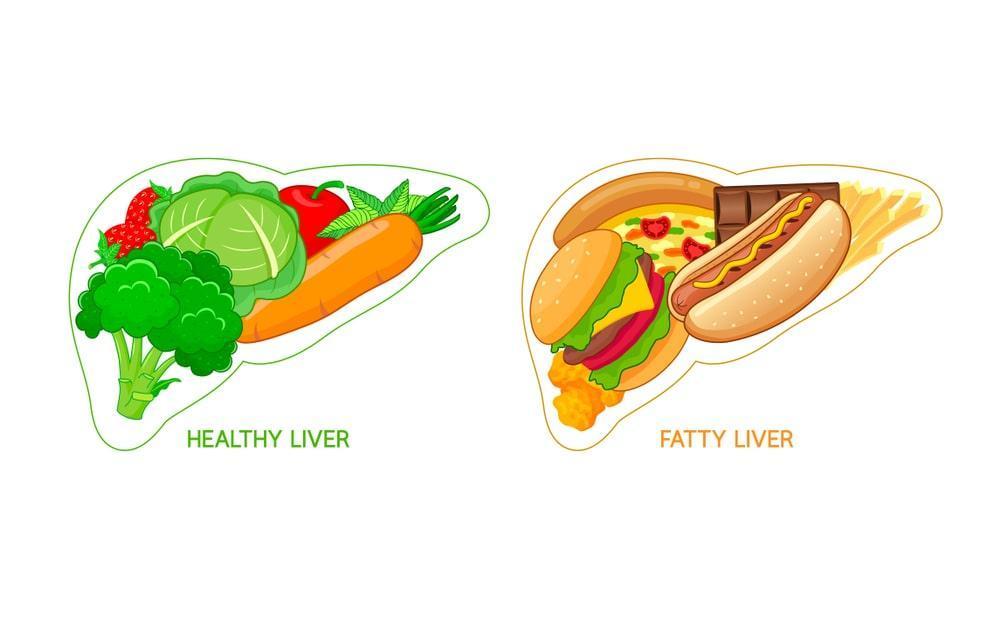 healthy liver and fatty liver food