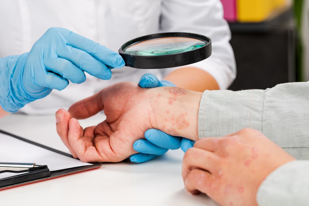 a doctor examining a hand with disease