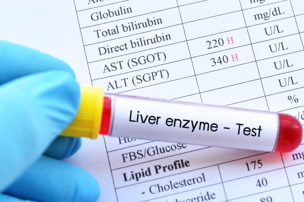 What Are Liver Enzymes