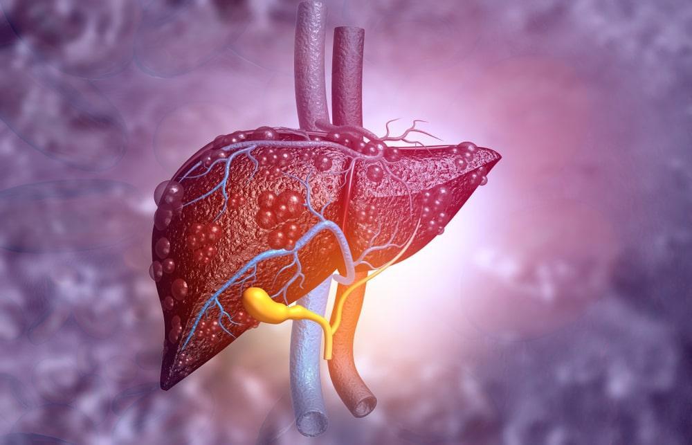 What are the 4 Stages of Liver Disease