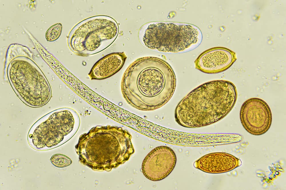 Mixed of Helminthes in Stool