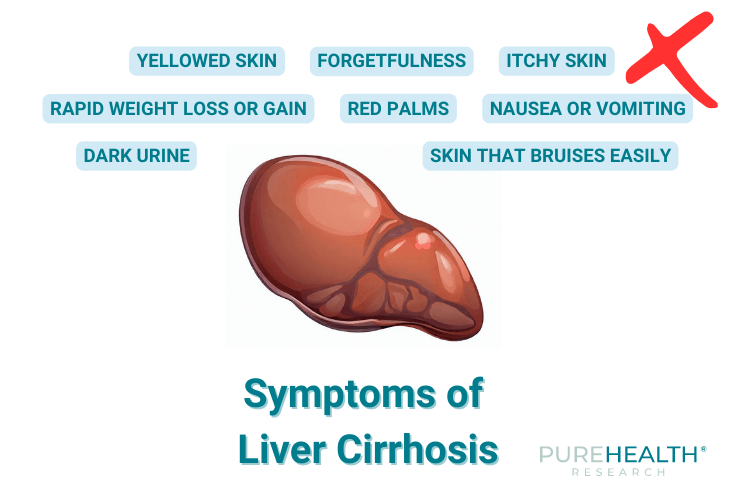 Liver cirrhosis symptoms illustration - yellowed skin, itchy skin, dark urine 