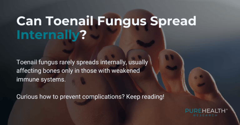 Can Toenail Fungus Spread Internally? | PureHealth Research