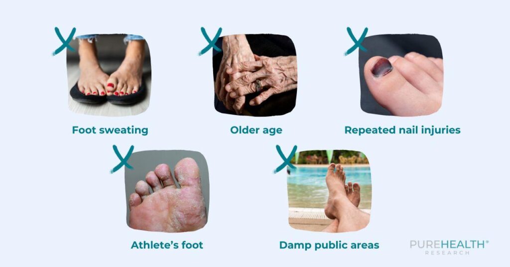 Stages of Toenail Fungus A Detailed Look PureHealth Research