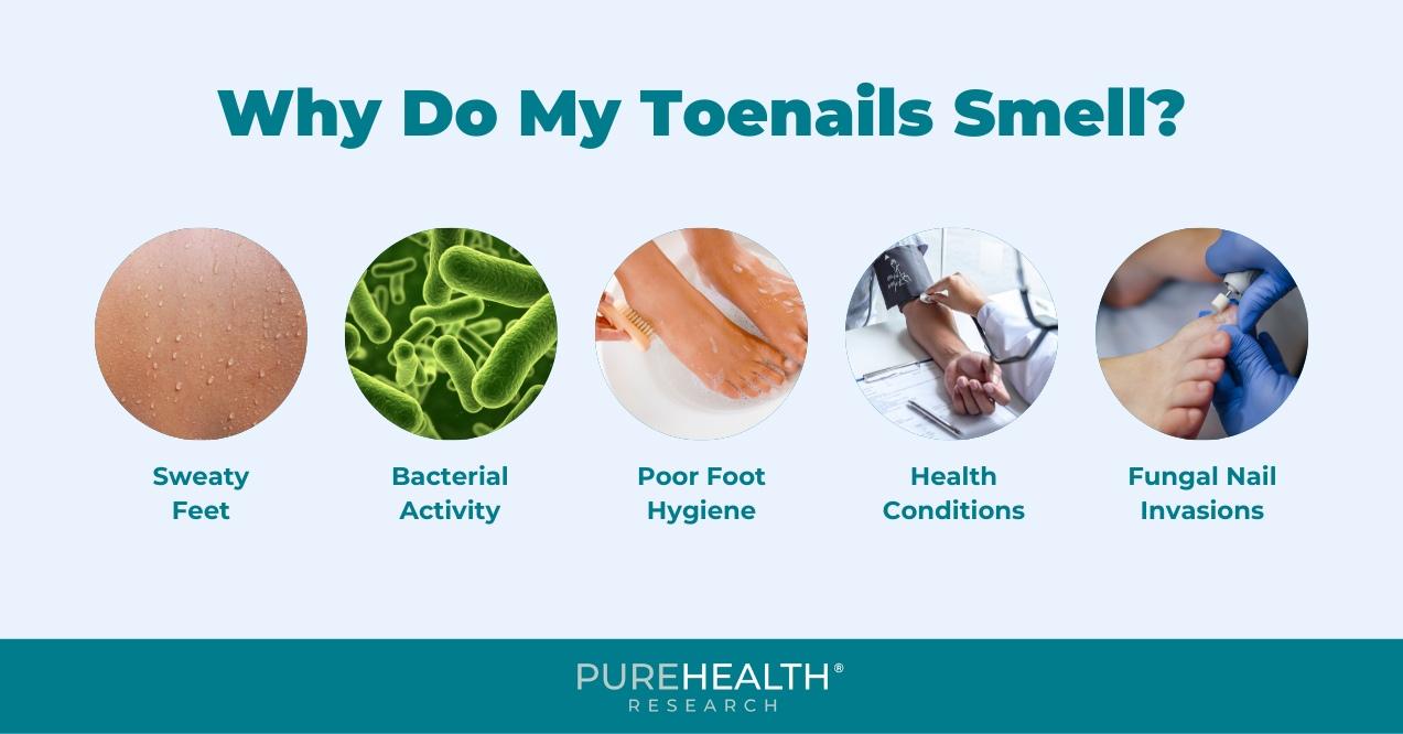 Why do my toenails smell illustration that illustrates sweaty feet, bacterial activity, poor foot hygiene, health conditions, and fungal nail infections