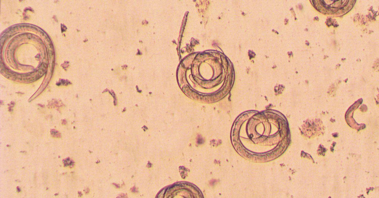 Trichinella spiralis - Parasitic Worm Under Microscope