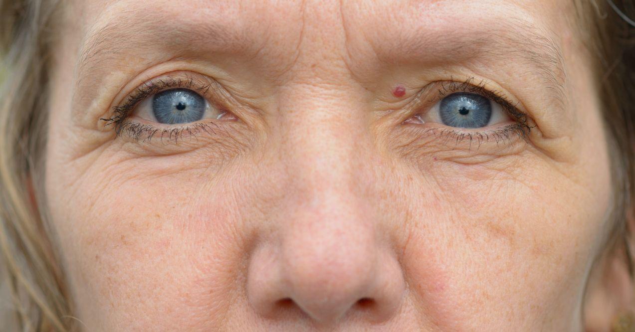Close-up of pale blue eyes and nose of middle age woman.