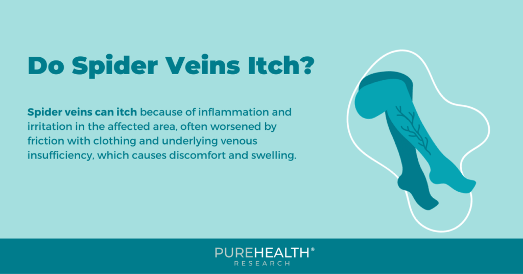 Infographic on spider vein itch