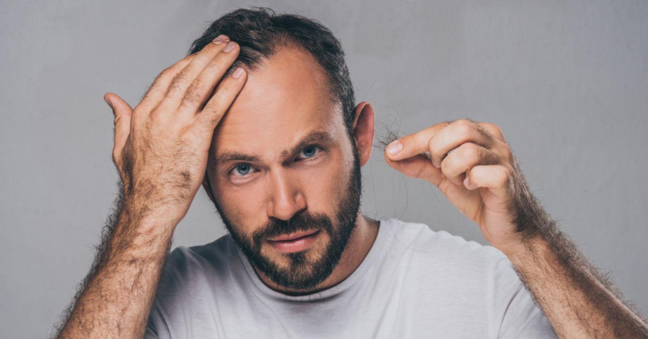 Middle aged man holding fallen hair and looking at camera 
