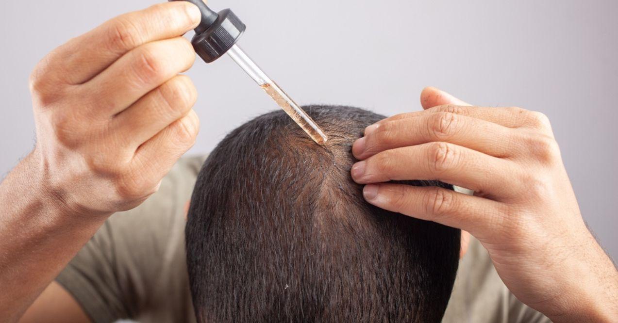 Man applies minoxidil oil on scalp