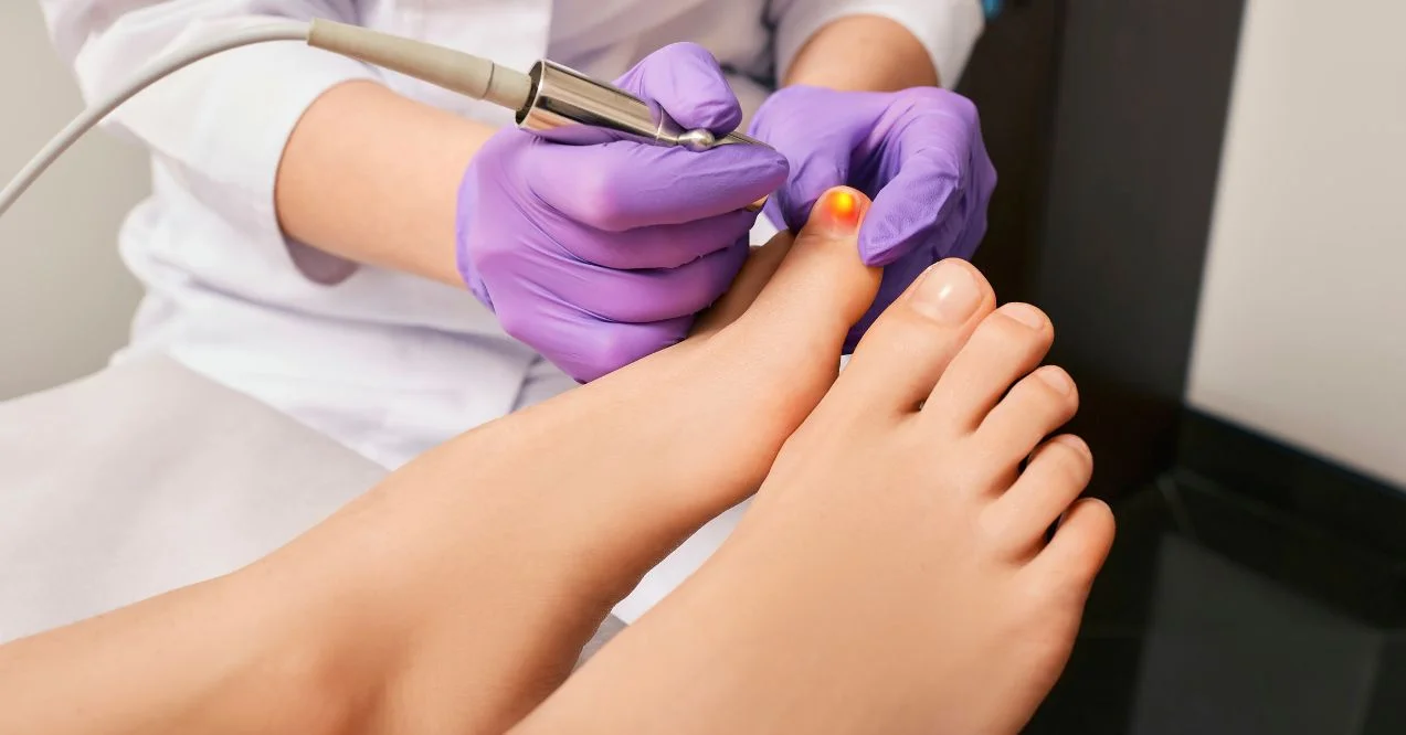 a healthcare professional using a specialized tool for treating toenail fungus on a patient's foot in a clinical setting