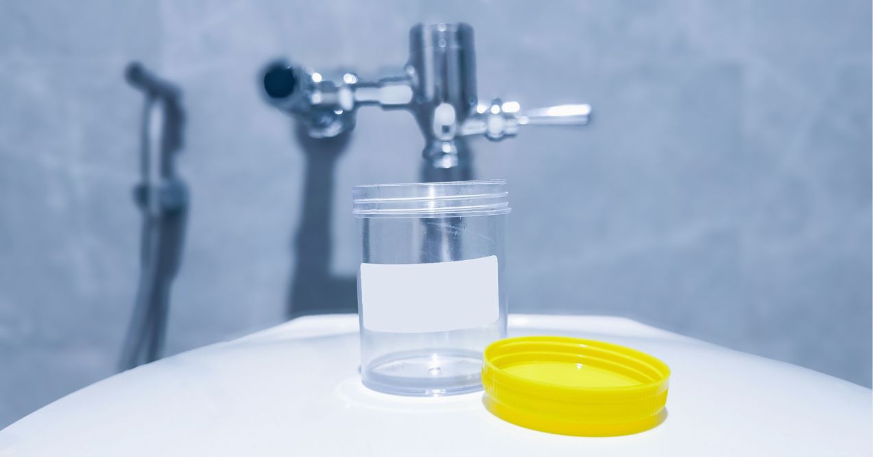 medical specimen collection bottle , urine test jar on the flush toilet