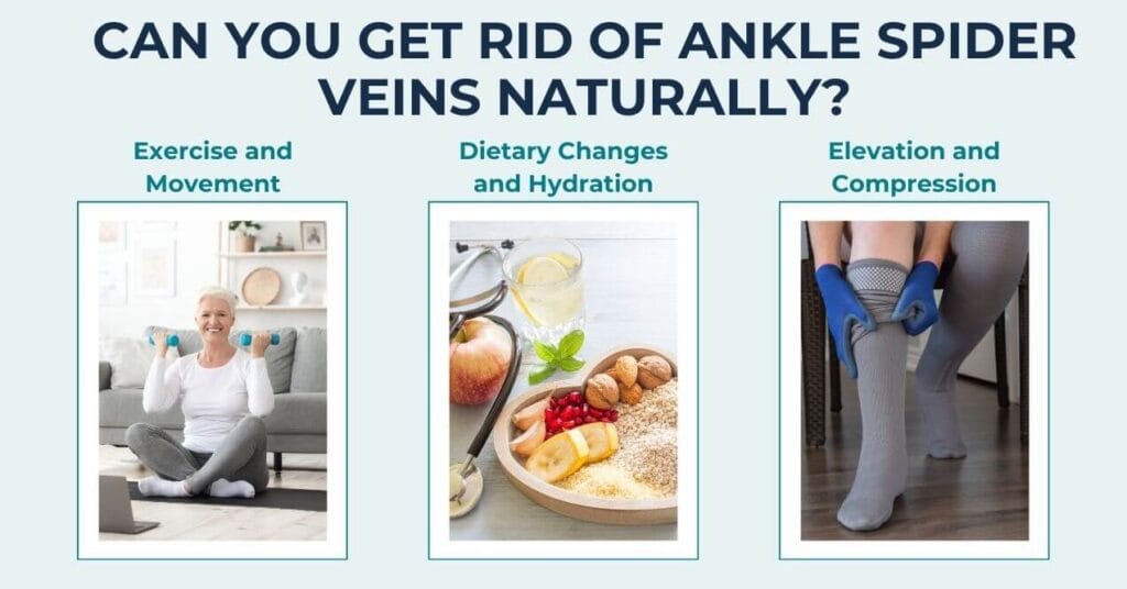 Spider Veins on Ankles: Causes, Prevention & Solutions | PureHealth ...