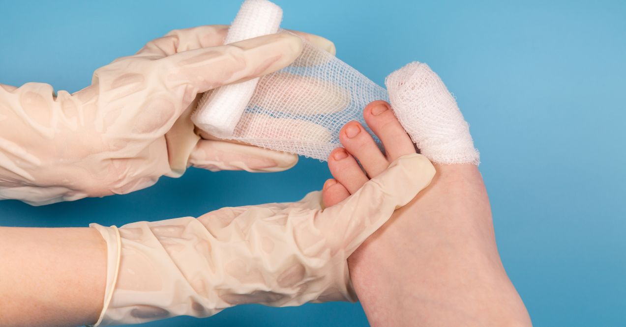 Signs of Infection After Toenail Removal Surgery: What to Look For