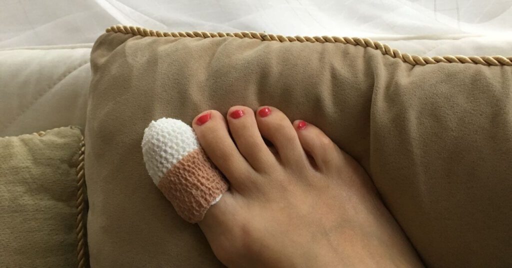 A foot resting on a cushion with a bandage wrapped around the big toe, covered in soft medical gauze