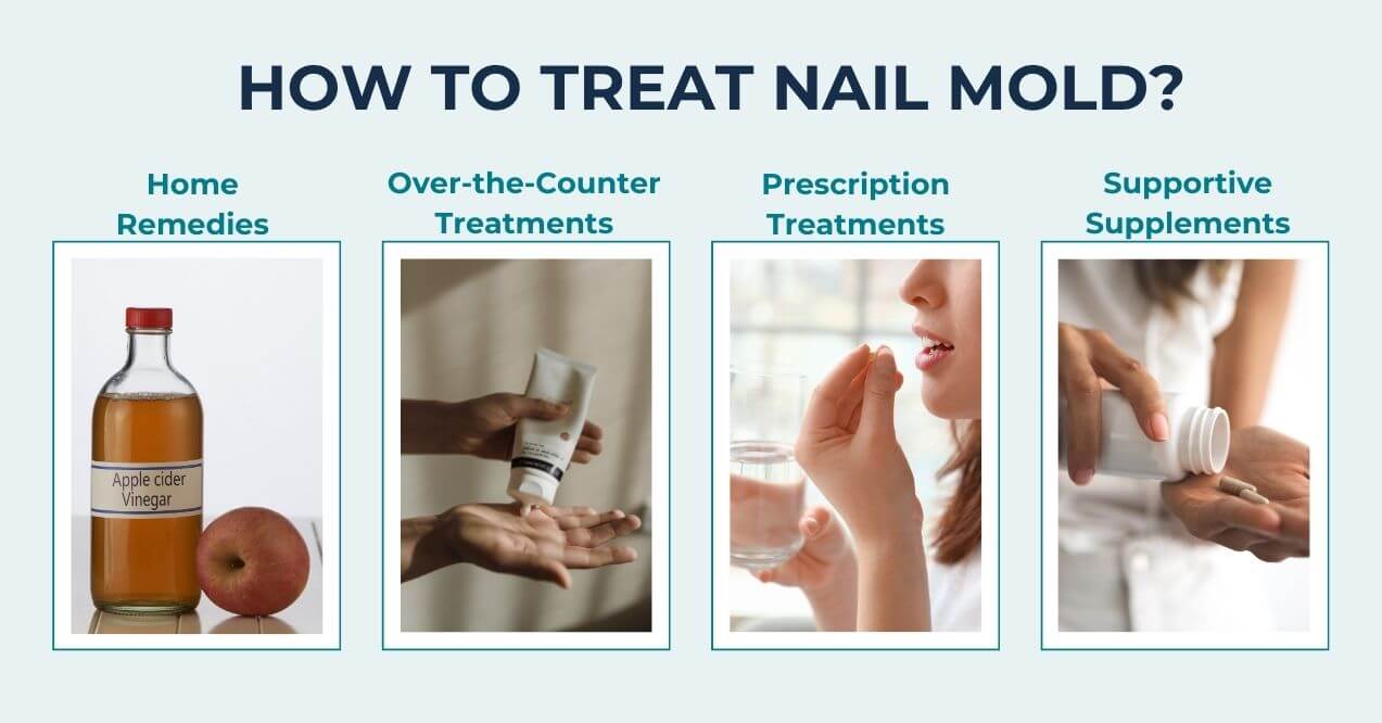 Nail mold treatment options: home remedies, OTC treatments, prescriptions, supplements.