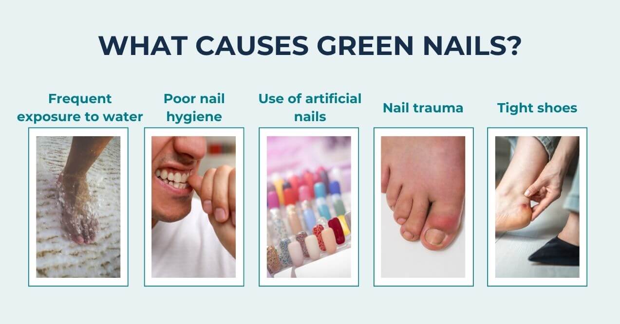 Causes of green nails: water exposure, poor hygiene, artificial nails, trauma, tight shoes.