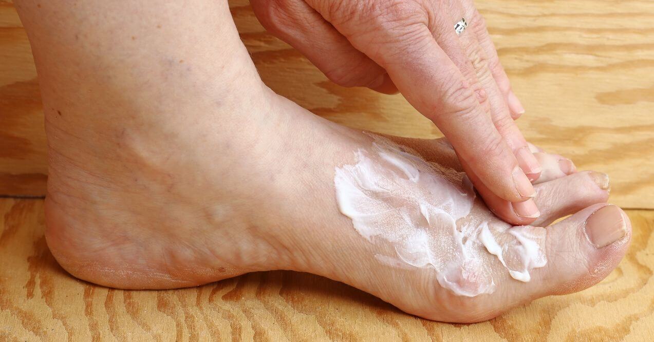 Person applying cream on their foot to moisturize dry skin and nails.