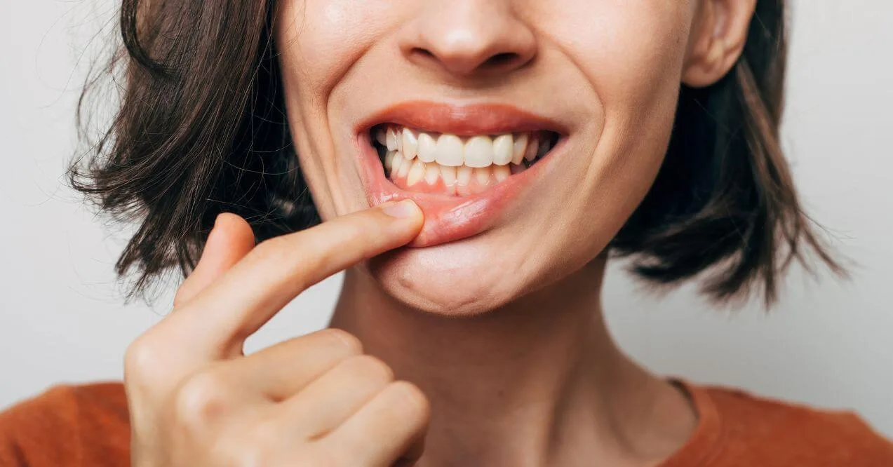 Woman pointing to her gums wondering how to improve gum health quickly