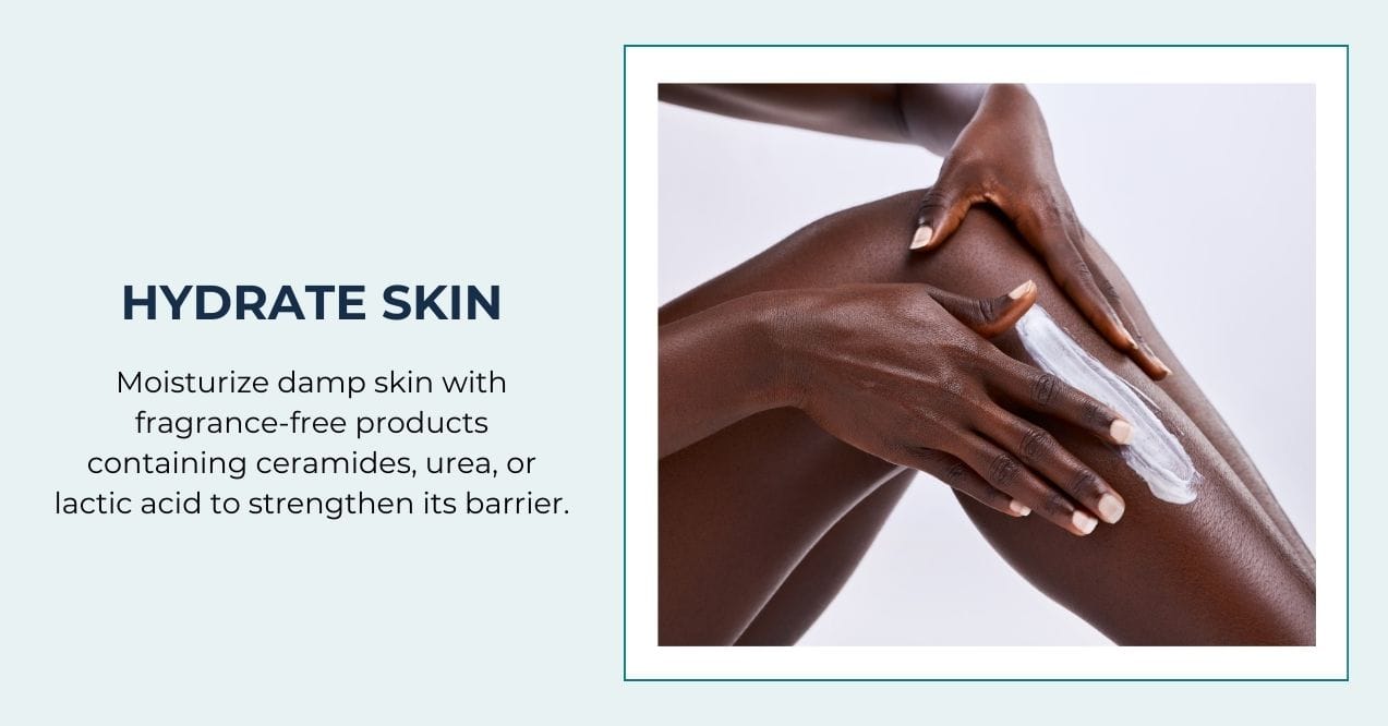 Moisturizing dry skin with a cream on the leg.