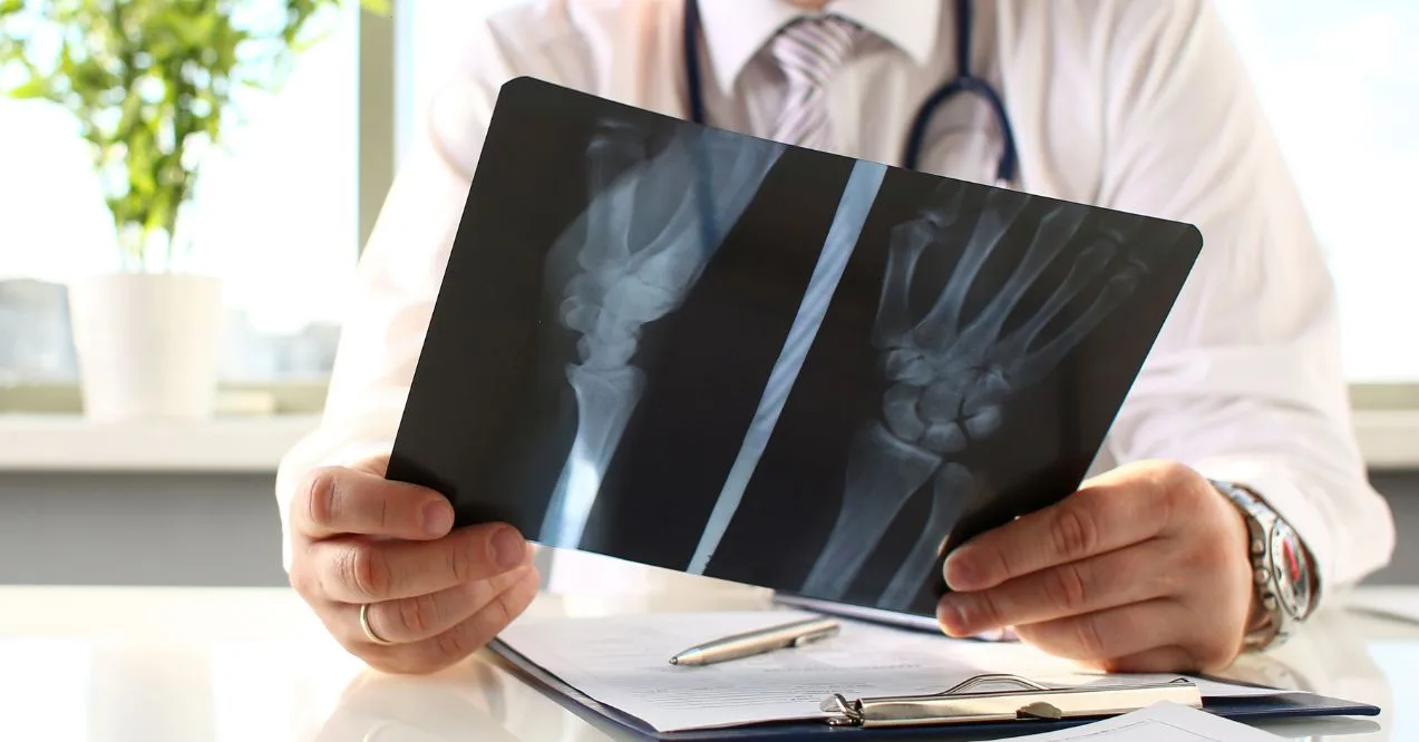 Doctor reviewing an X-ray of a fractured wrist.