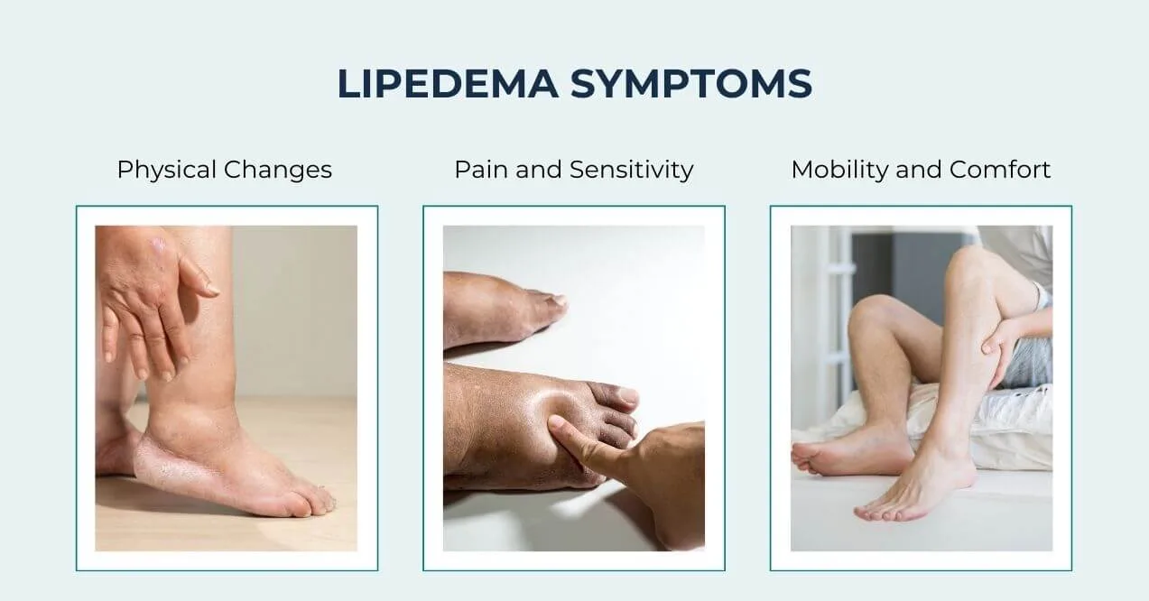 Symptoms of lipedema including physical changes, pain, and mobility issues.
