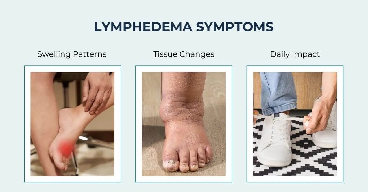 Symptoms of lymphedema showing swelling, tissue changes, and daily impact.