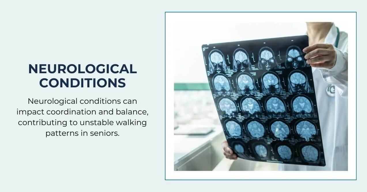 Doctor showing a brain scan to discuss neurological conditions.