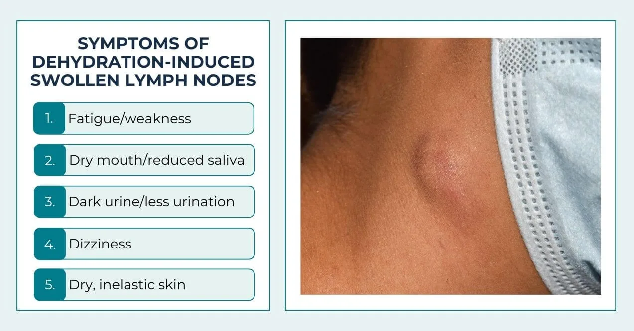 A list of symptoms on the left and a close-up of a swollen lymph node on the right.