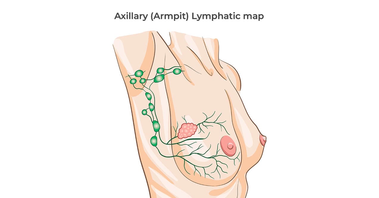Axillary lymphatic map showing lymph nodes and vessels in the armpit and breast area.
