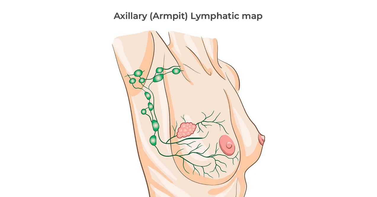 Axillary lymphatic map showing lymph nodes and vessels in the armpit and breast area.
