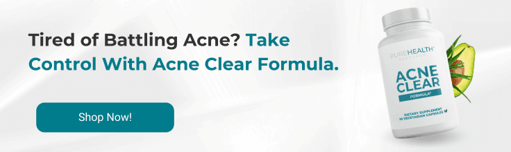 CTA banner showing acne clear formula supplement