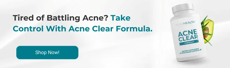 CTA banner showing acne clear formula supplement