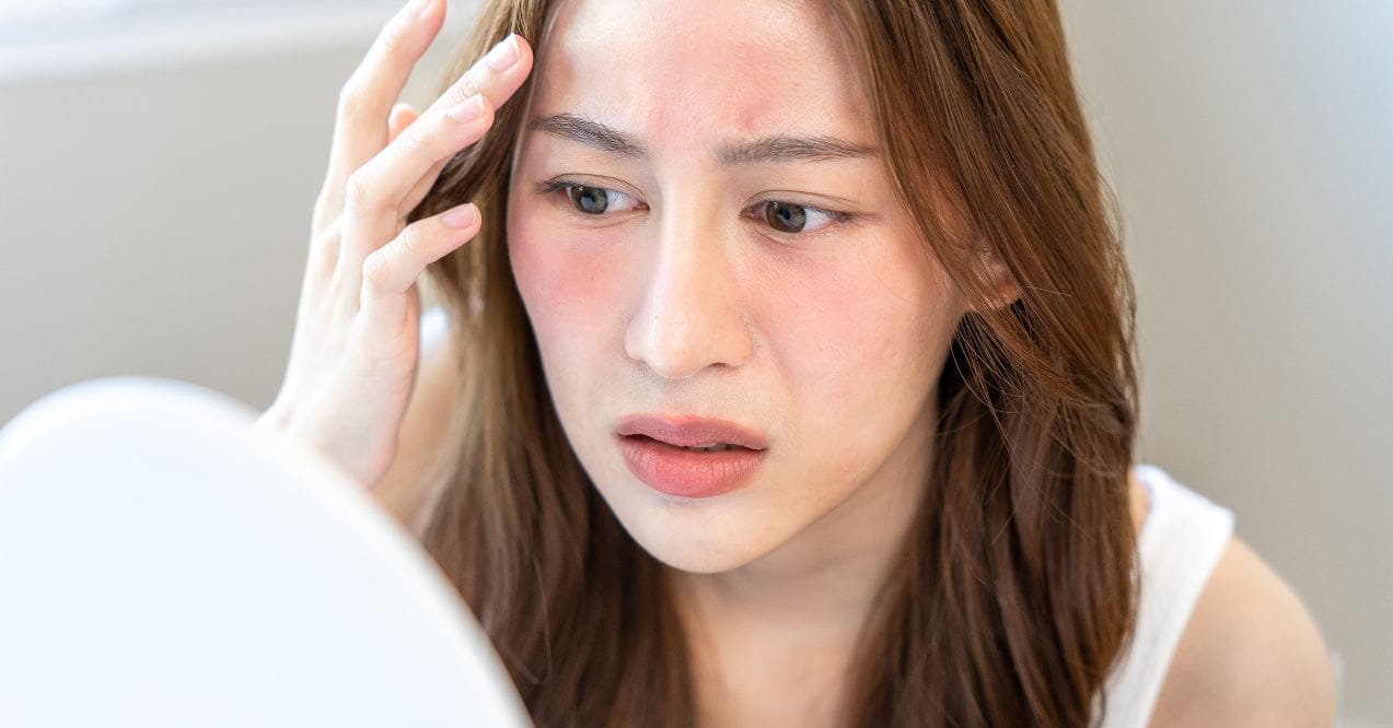 Woman with facial redness and concern looking into mirror