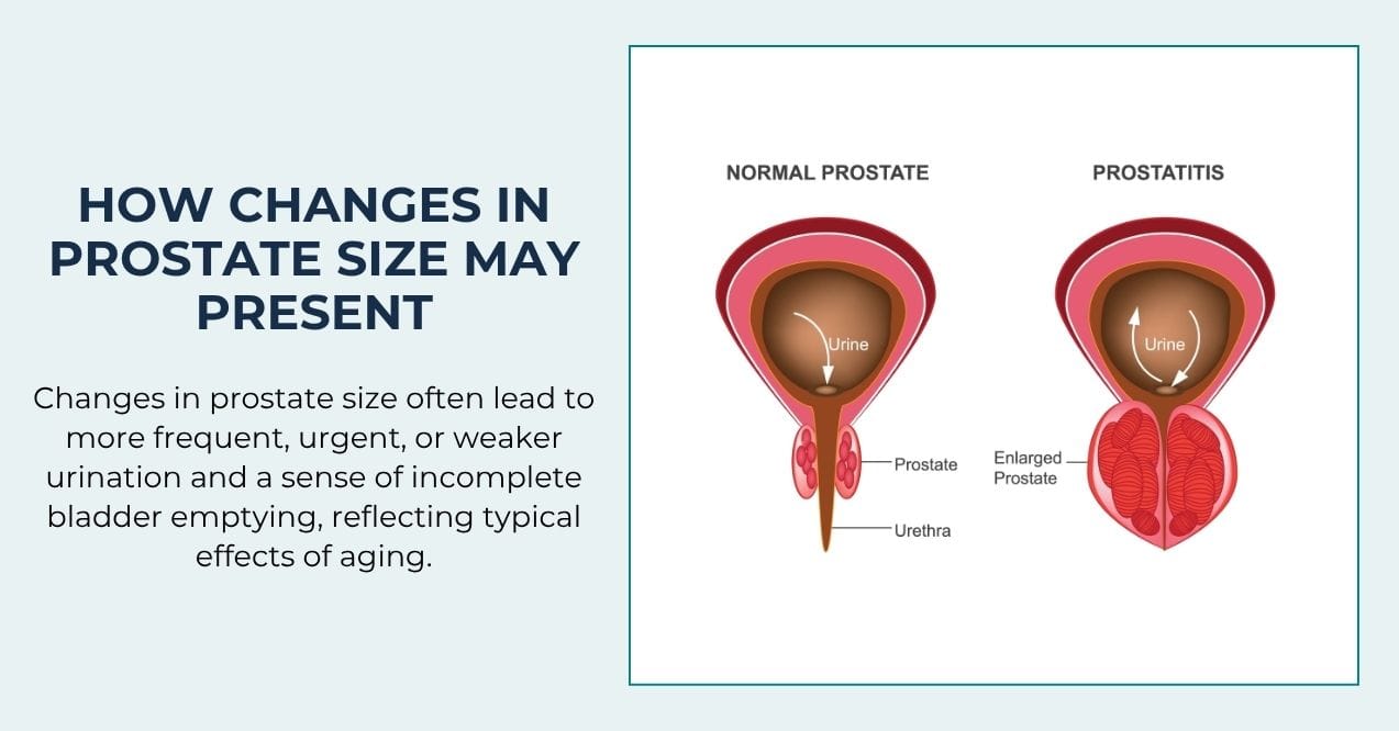 Illustration showing normal vs. enlarged prostate and effects on urination