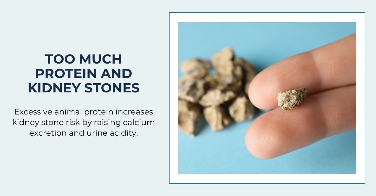 Close-up of a hand holding a kidney stone with some stones in the background.