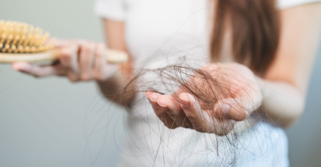 Woman holding a large clump of fallen hair resembling can liver issues cause hair loss