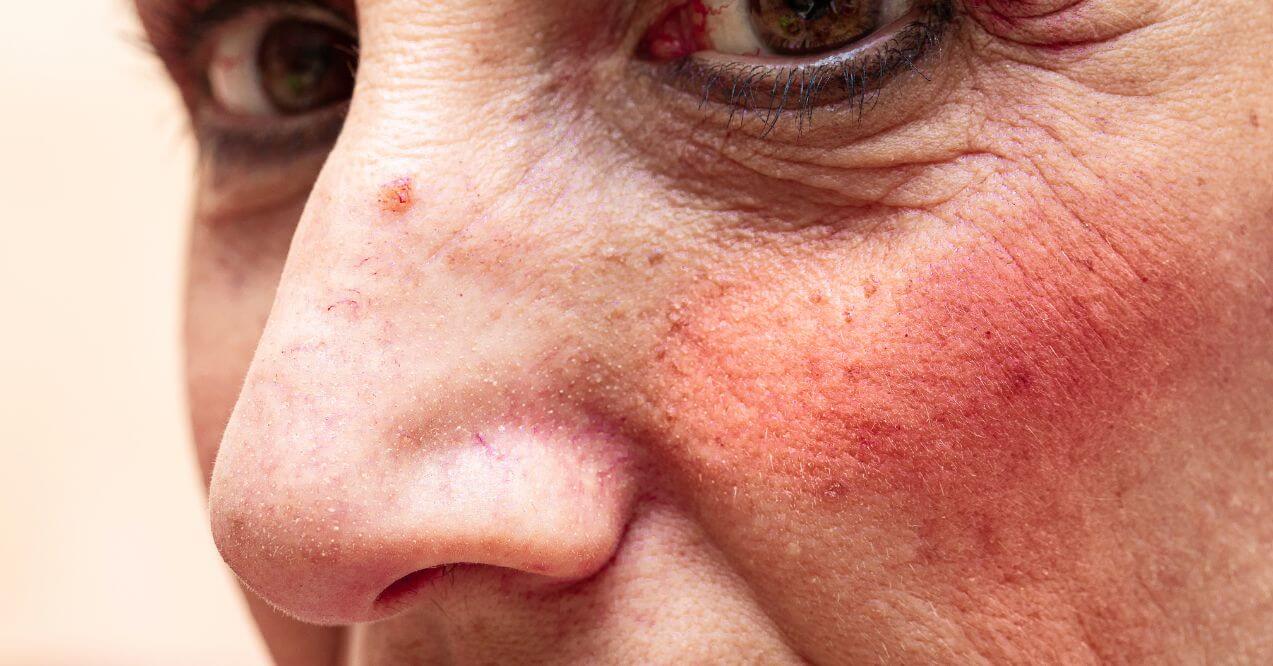 Close-up of damaged skin cells resembling the topic of how to repair damaged cells naturally