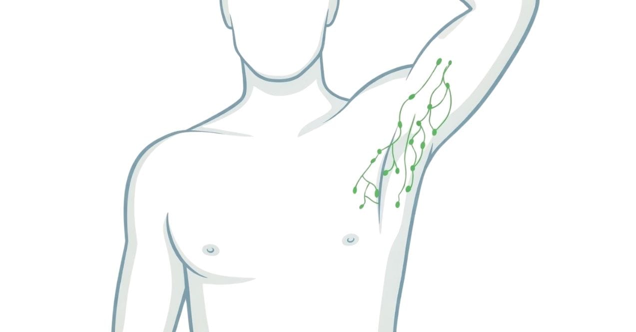 Diagram of axillary lymph nodes and lymphatic vessels in the armpit area