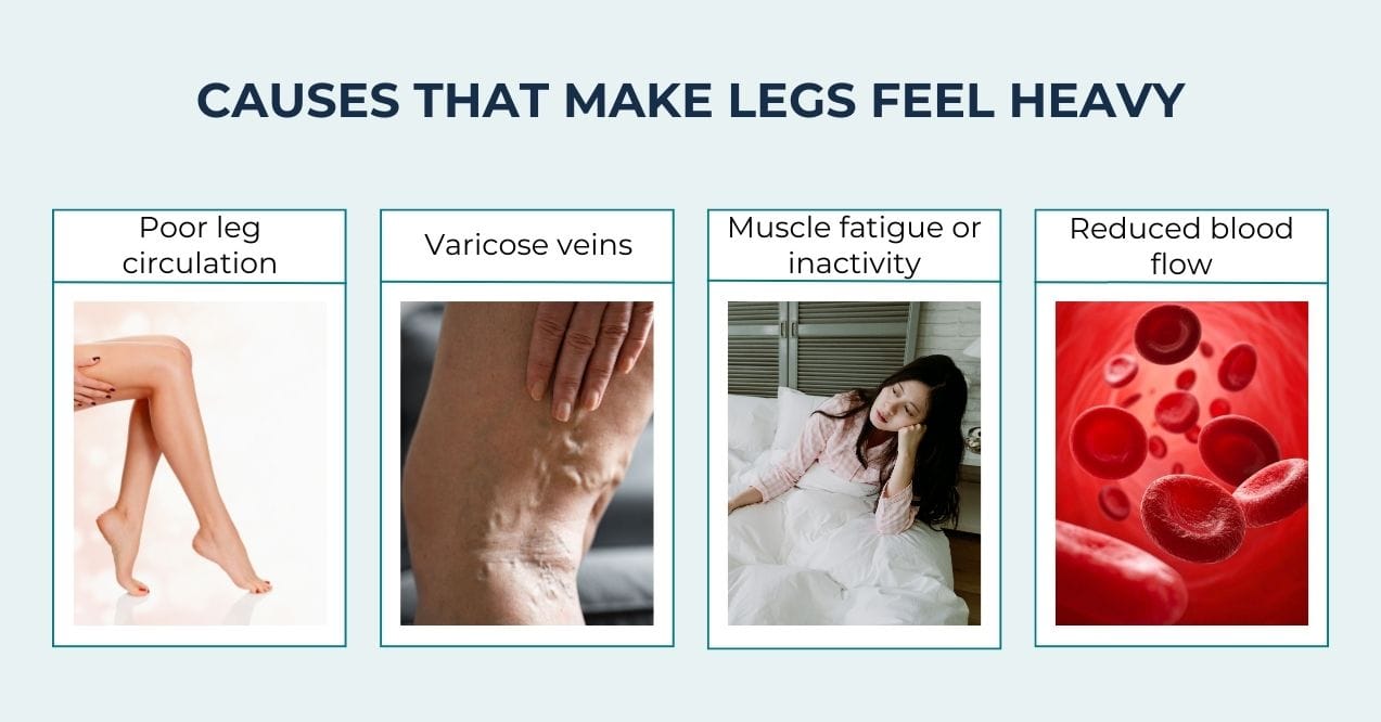 Infographic showing causes of heavy legs