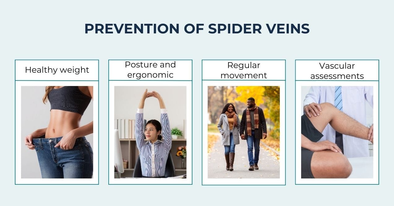 Infographic showing lifestyle steps to help prevent spider veins