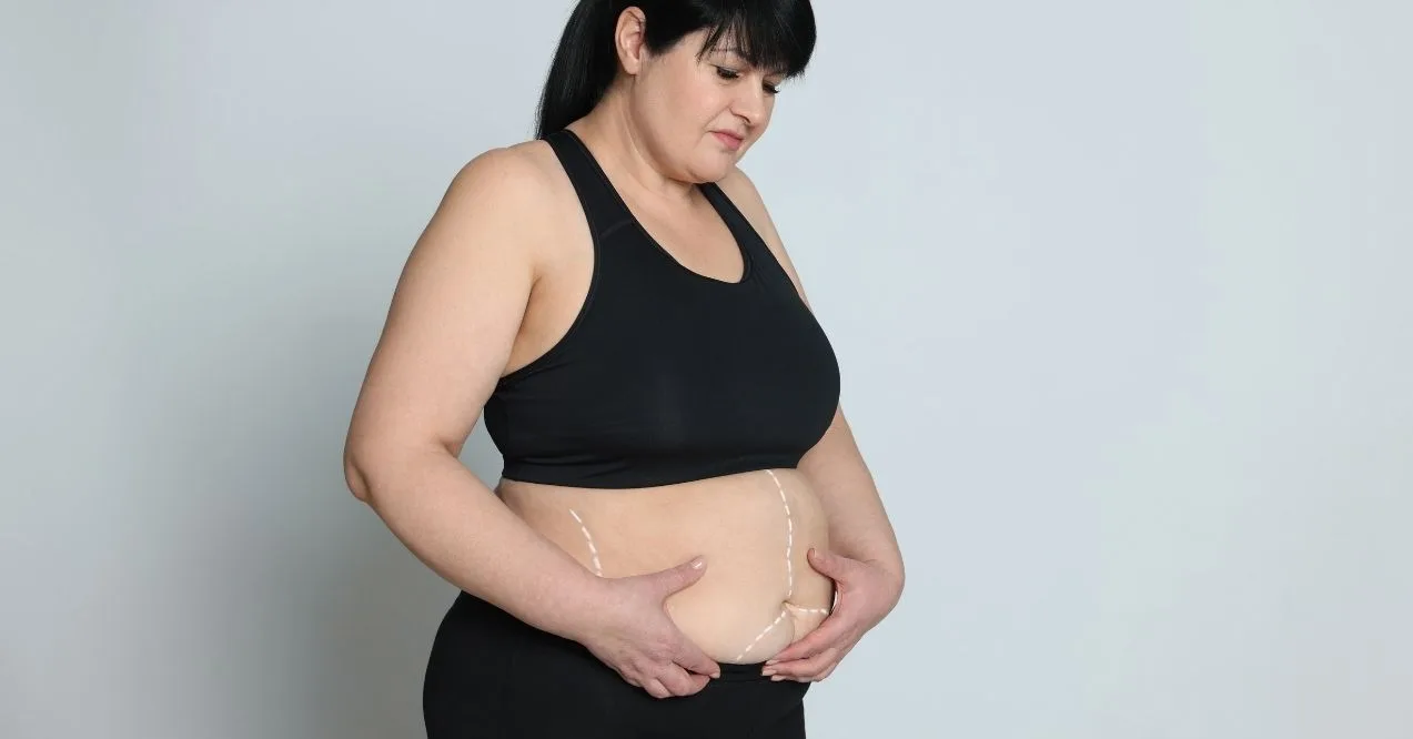Woman looking at her abdomen with marked waist lines