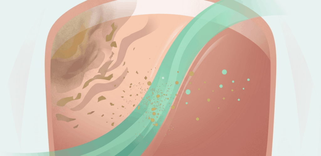 Toenail Changes in Texture