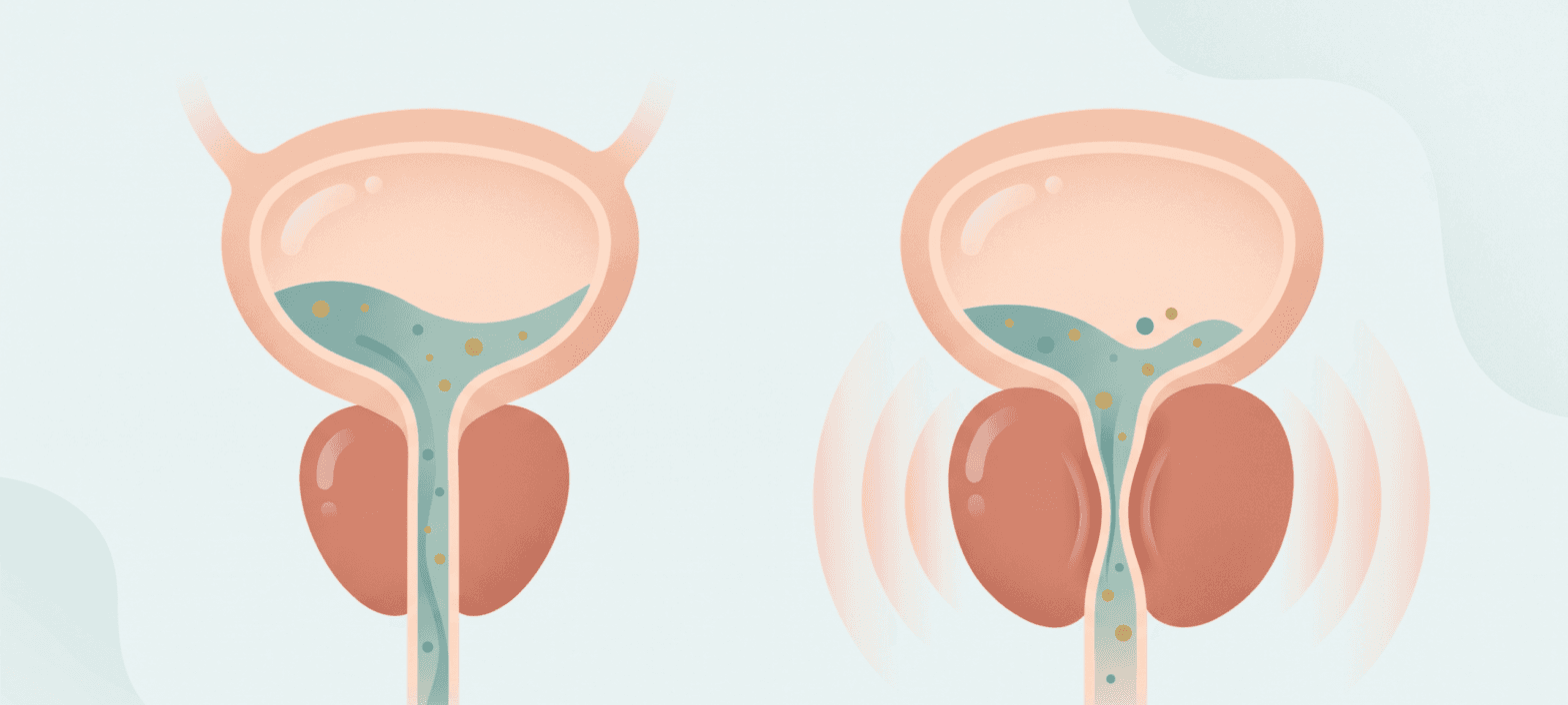 What Size of Prostate Is Dangerous