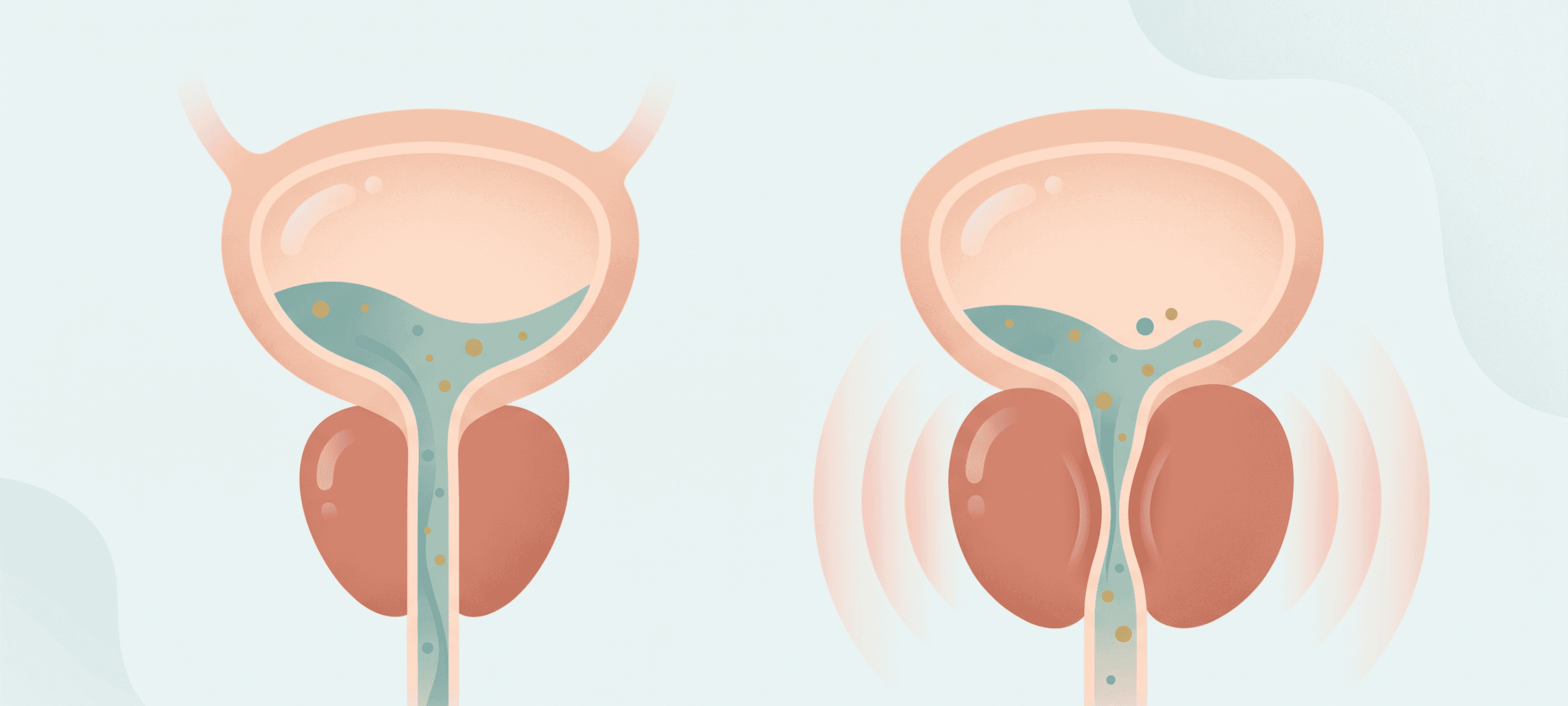 What Size of Prostate Is Dangerous
