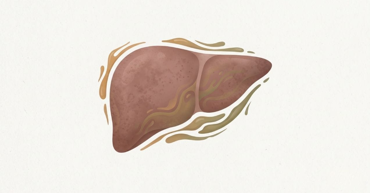 Illustration of a sluggish liver with reduced bile flow