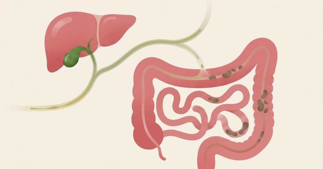 What is the connection between liver and constipation the gut-liver axis explained